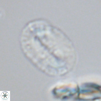 Helicosphaeranudus hyalina VR 09362