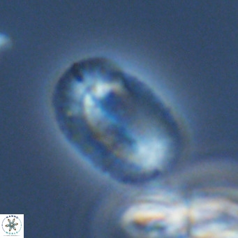 Helicosphaeranudus hyalina VR 09364
