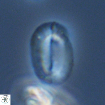 Helicosphaeranudus hyalina VR 09365