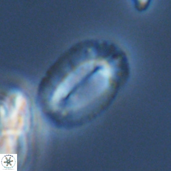 Helicosphaeranudus hyalina VR 09366