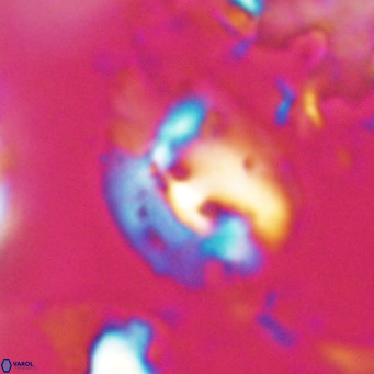 Helicosphaerella bipuncta VR 028468