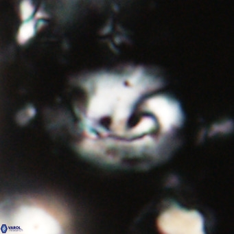 Helicosphaerella bipuncta VR 028469