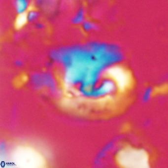 Helicosphaerella bipuncta VR 028470