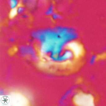 Helicosphaerella bipuncta VR 028470