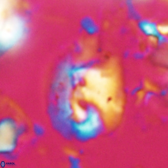 Helicosphaerella bipuncta VR 028471