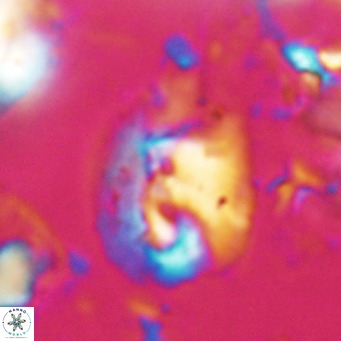 Helicosphaerella bipuncta VR 028471