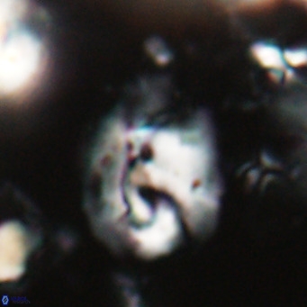 Helicosphaerella bipuncta VR 028472