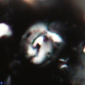 Helicosphaerella bipuncta VR 028473