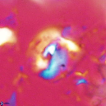 Helicosphaerella bipuncta VR 028474