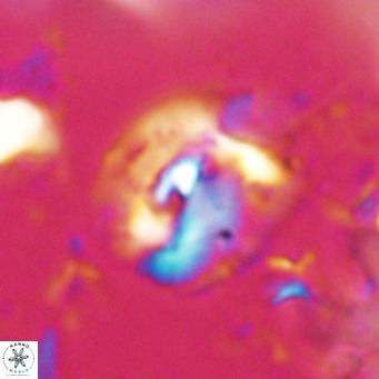 Helicosphaerella bipuncta VR 028474