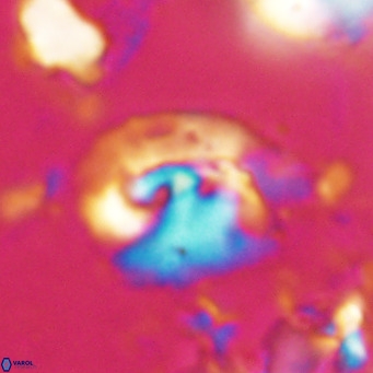 Helicosphaerella bipuncta VR 028475