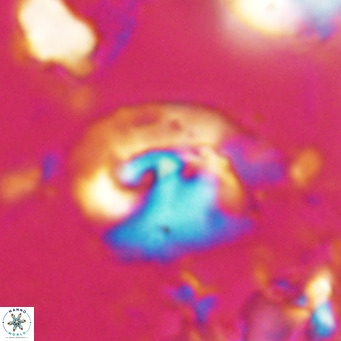Helicosphaerella bipuncta VR 028475