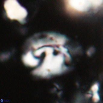 Helicosphaerella bipuncta VR 028476