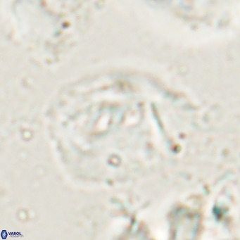 Helicosphaerella bipuncta VR 028477
