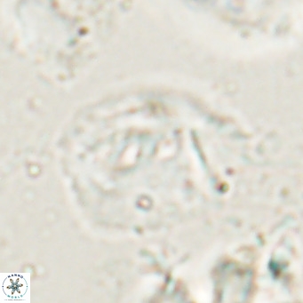 Helicosphaerella bipuncta VR 028477