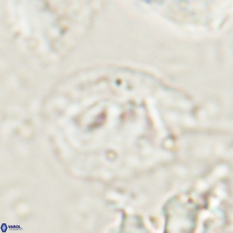 Helicosphaerella bipuncta VR 028478