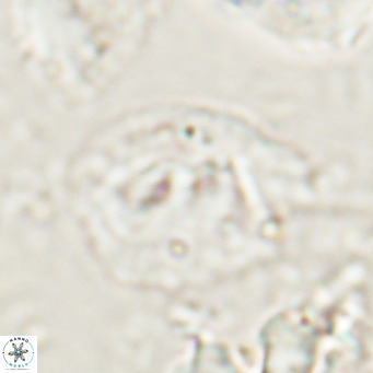 Helicosphaerella bipuncta VR 028478