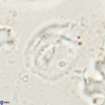 Helicosphaerella bipuncta VR 028479