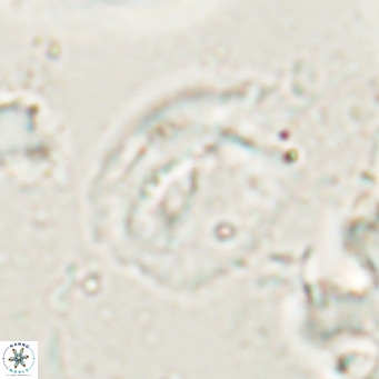 Helicosphaerella bipuncta VR 028479