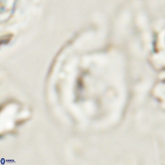 Helicosphaerella bipuncta VR 028480