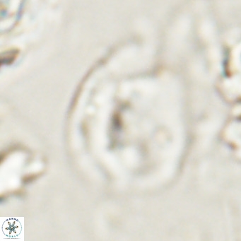 Helicosphaerella bipuncta VR 028480