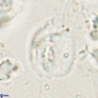 Helicosphaerella bipuncta VR 028481