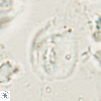 Helicosphaerella bipuncta VR 028481