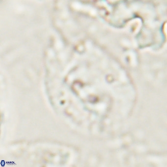 Helicosphaerella bipuncta VR 028482