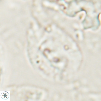 Helicosphaerella bipuncta VR 028482