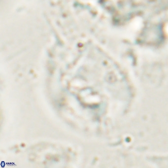 Helicosphaerella bipuncta VR 028483