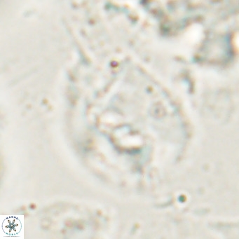 Helicosphaerella bipuncta VR 028483