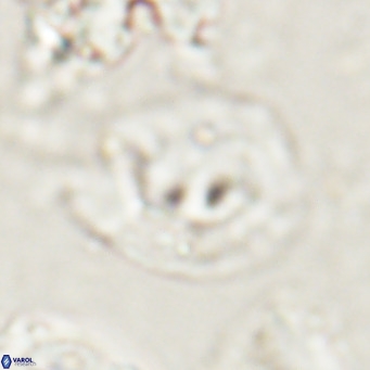 Helicosphaerella bipuncta VR 028484