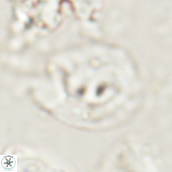 Helicosphaerella bipuncta VR 028484