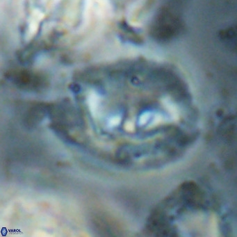 Helicosphaerella bipuncta VR 028485