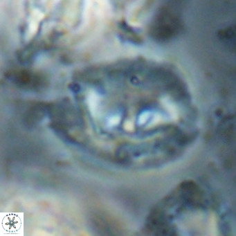 Helicosphaerella bipuncta VR 028485