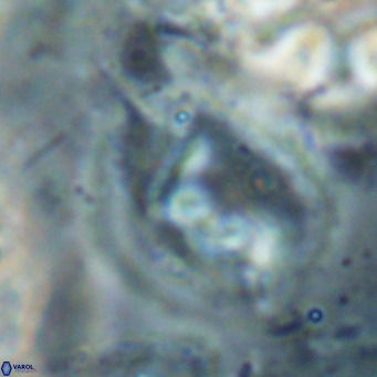 Helicosphaerella bipuncta VR 028486