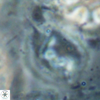 Helicosphaerella bipuncta VR 028486