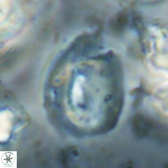 Helicosphaerella bipuncta VR 028487