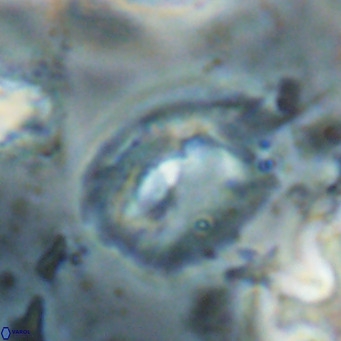 Helicosphaerella bipuncta VR 028488