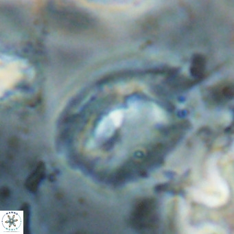 Helicosphaerella bipuncta VR 028488
