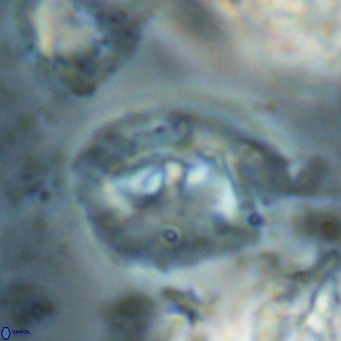 Helicosphaerella bipuncta VR 028489