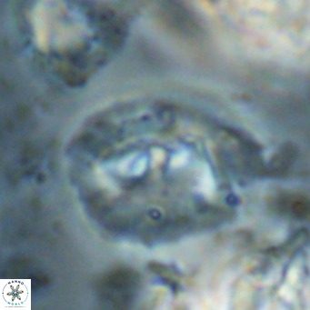 Helicosphaerella bipuncta VR 028489