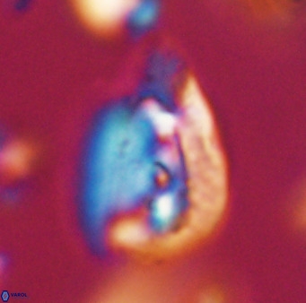 Helicosphaerella bipuncta VR 32964