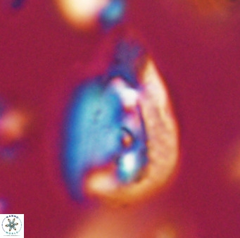 Helicosphaerella bipuncta VR 32964