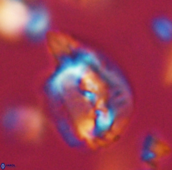 Helicosphaerella bipuncta VR 32965