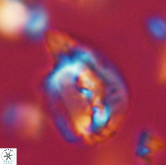 Helicosphaerella bipuncta VR 32965