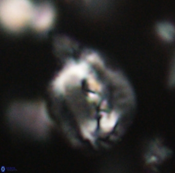 Helicosphaerella bipuncta VR 32966