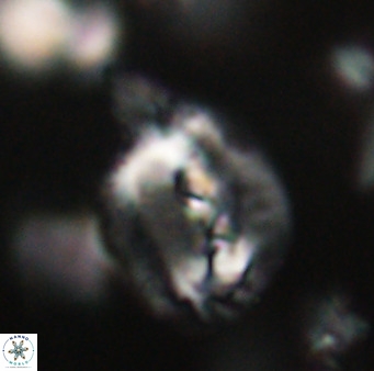 Helicosphaerella bipuncta VR 32966