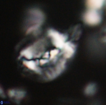 Helicosphaerella bipuncta VR 32967
