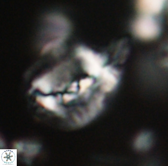 Helicosphaerella bipuncta VR 32967